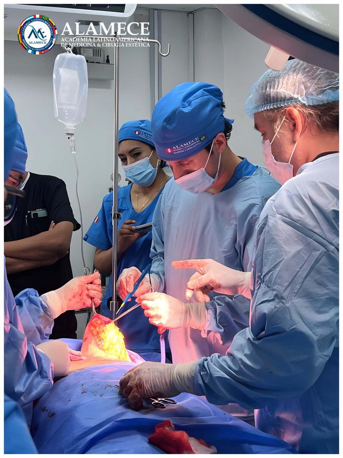 ALAMECE Curso Cirugia Estetica de las Mamas maxtopexia mamoplastias 01