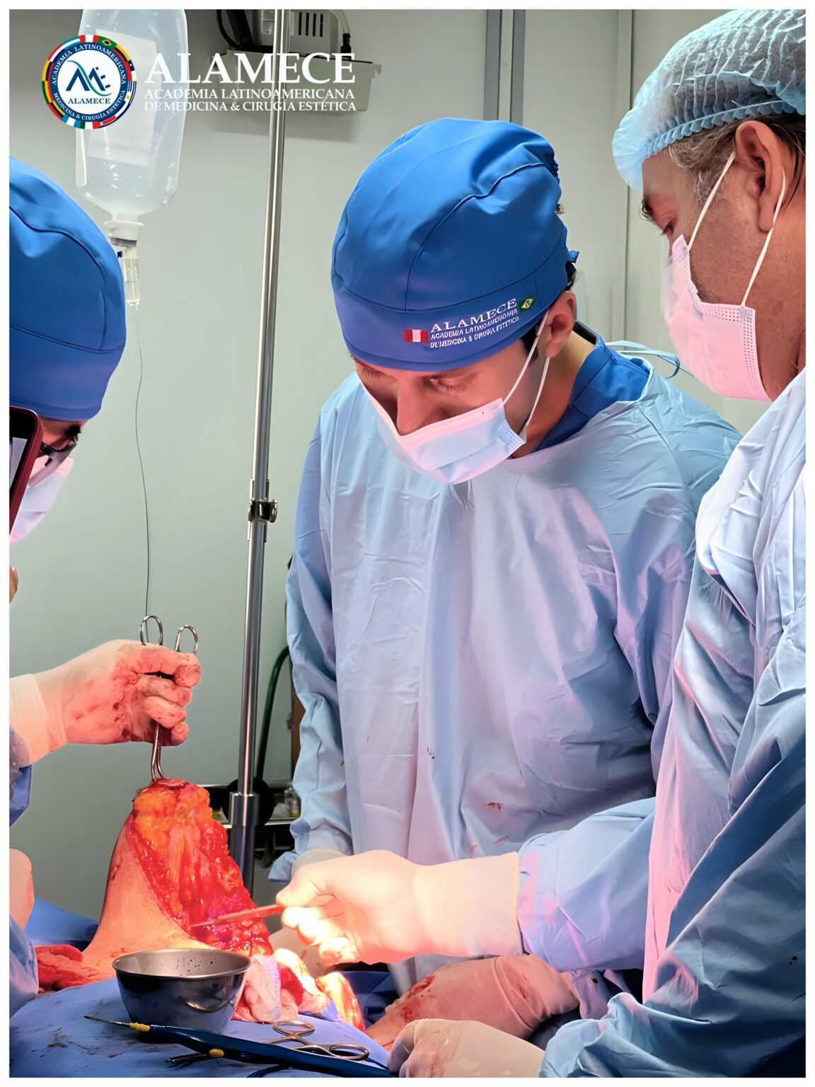ALAMECE Curso Cirugia Estetica de las Mamas maxtopexia mamoplastias 03