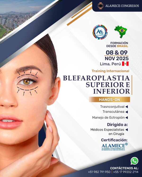 Blefaroplastia Superior e inferior