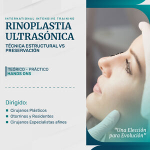 Rinoplastia Ultrasónica