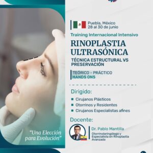 Rinoplastia Ultrasónica