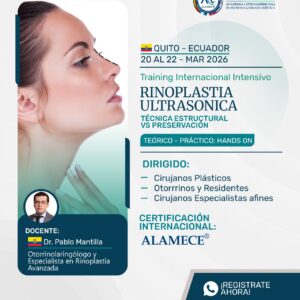 Rinoplastia Ultrasónica