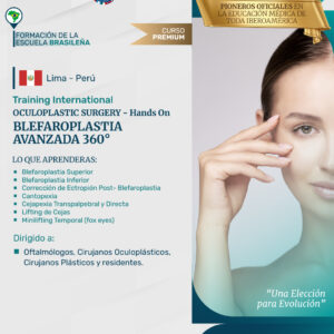 Training Internacional – Oculoplastic Surgery Blefaroplastia Avanzada 360 º